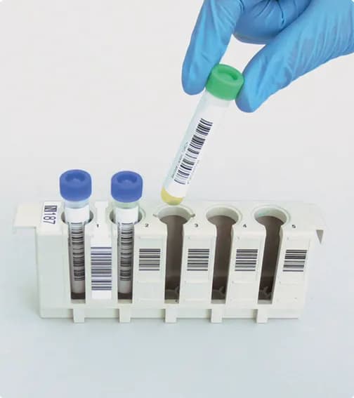Optitrol NAT HIV-2