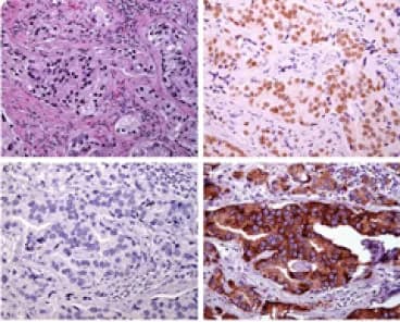 Human Anti-NKX3.1 IgG, 0.1 mg