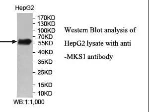 Anti-MKS1