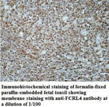 Anti-FCRL4