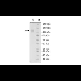 Spike S1 (B.1.1.7, Alpha Variant), Avi-His-Tag (SARS-CoV-2)