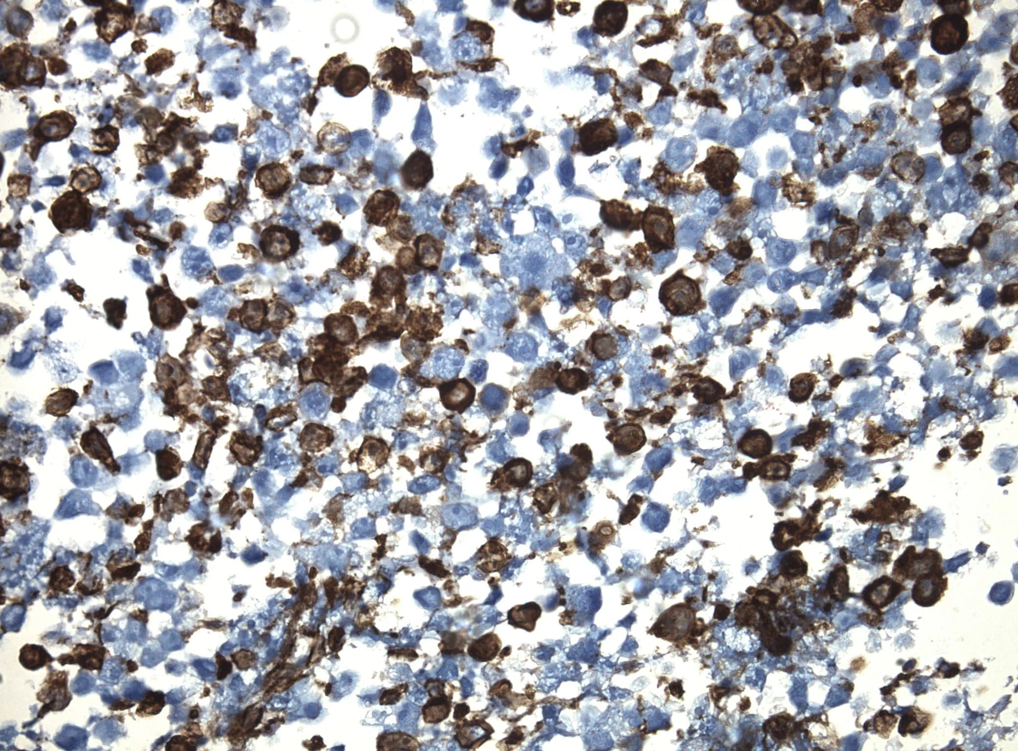 CD8A CytoSection