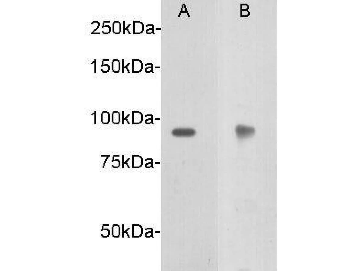 Netrin receptor DCC Rabbit Polyclonal Antibody