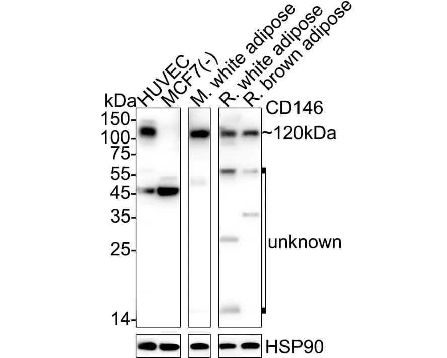 MCAM (CD146) Rabbit Polyclonal Antibody