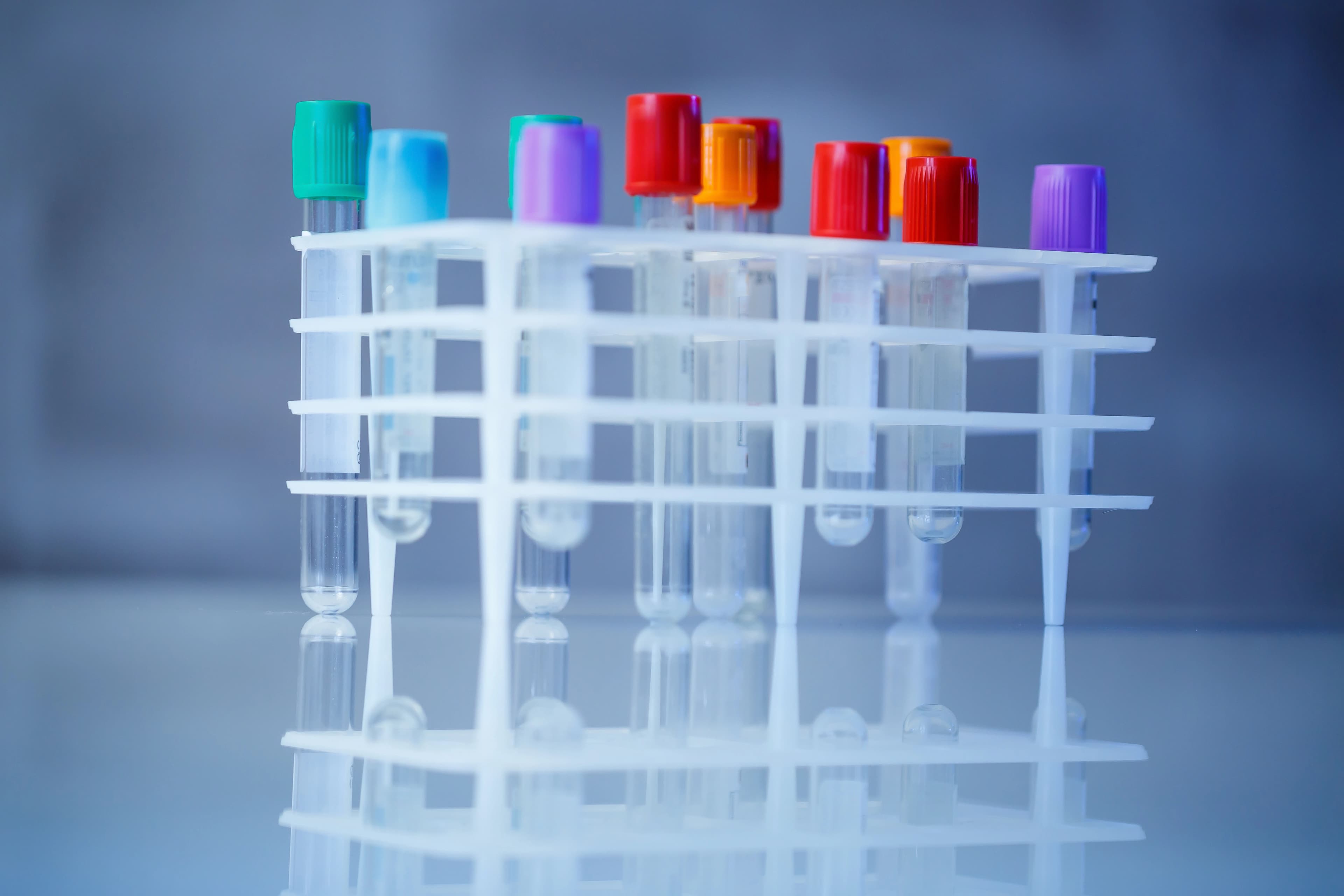 Screw Cap, Microcentrifuge and Low-Retention Tubes for Laboratory Sample Handling